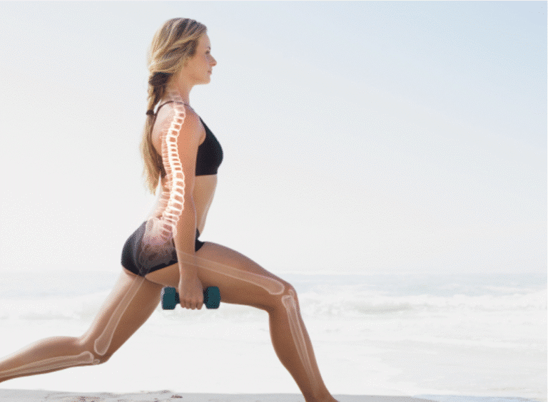 Bone support