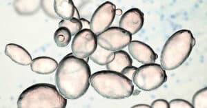 Probiotic Yeasts - What are they?